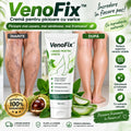 Cremă Pentru Varice VenoFix – Picioare Mai Ușoare și Mai Frumoase